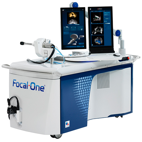 Focal One® HIFU - лечение опухолей предстательной железы ультразвуком. 